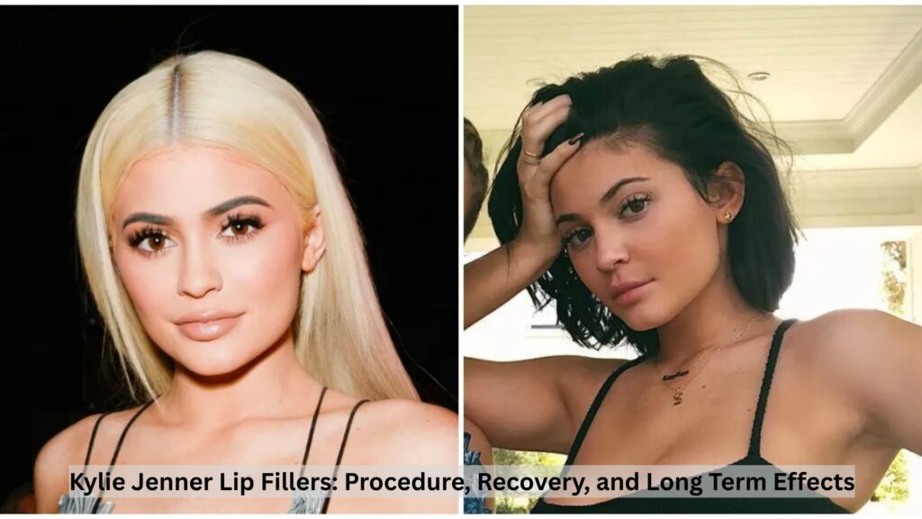 Kylie Jenner Lip Fillers: Procedure, Recovery, and Long Term Effects