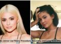 Kylie Jenner Lip Fillers: Procedure, Recovery, and Long Term Effects