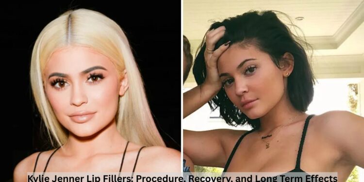 Kylie Jenner Lip Fillers: Procedure, Recovery, and Long Term Effects